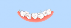 孩子四五岁就能矫正牙齿？听听资深口腔医生怎么说